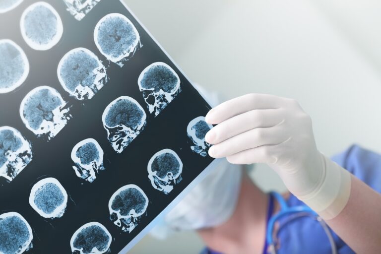 Radiology Billing Services